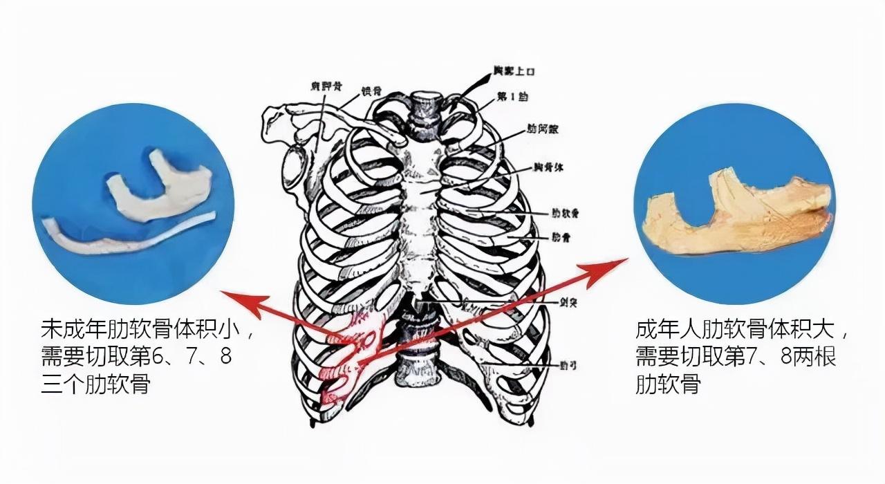 在线医生，守护肋骨健康的守护者